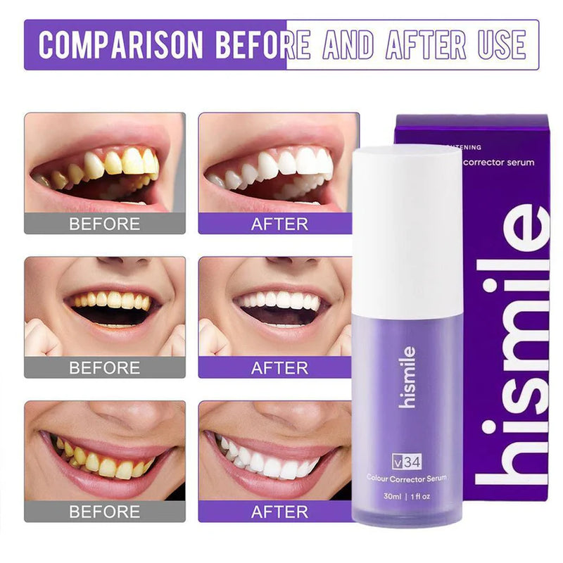 HiSmile - V34 Colour Corrector Serum
